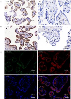 De novo Synthesis of SAA1 in the Placenta Participates in Parturition